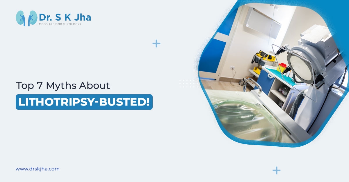 Top 7 Myths About Lithotripsy—Busted!