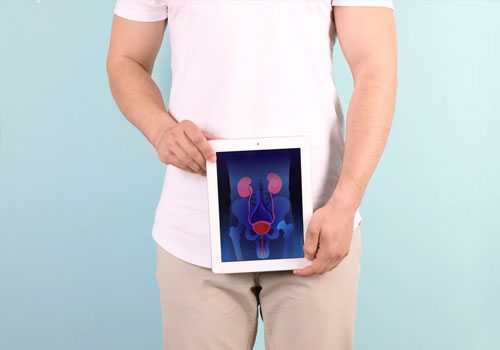 Prostate Cancer 
